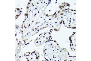 Immunohistochemistry of paraffin-embedded human placenta using FOSB Rabbit pAb (ABIN7267159) at dilution of 1:150 (40x lens). (FOSB 抗体  (AA 1-100))