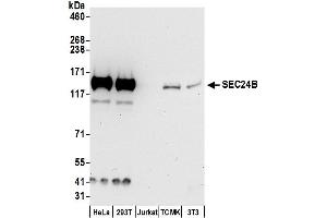 anti-SEC24 Family, Member B (SEC24B) (AA 1-50) antibody
