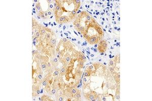Immunohistochemical analysis of paraffin-embedded H. (MAD2L2 抗体  (C-Term))