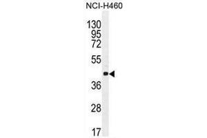 CCNC Antibody (N-term) western blot analysis in NCI-H460 cell line lysates (35µg/lane). (Cyclin C 抗体  (N-Term))