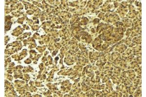 ABIN6275418 at 1/100 staining Mouse pancreas tissue by IHC-P. (S100A16 抗体  (Internal Region))