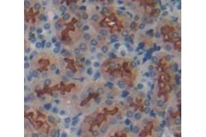 IHC-P analysis of Mouse Tissue, with DAB staining. (ITGB1 抗体  (AA 454-714))