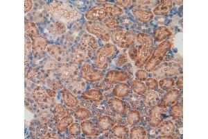 IHC-P analysis of kidney tissue, with DAB staining. (LIFR 抗体  (AA 152-291))
