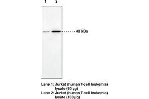Image no. 1 for anti-Cannabinoid Receptor 2 (CNR2) (AA 20-33) antibody (ABIN1491167) (CNR2 抗体  (AA 20-33))