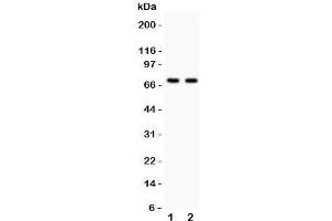 Western blot testing of SHBG antibody and Lane 1:  HeLa;  2: COLO320;  Predicted size per AA content: 44KD, but this highly glycosylated protein is observed up to 100KD (SHBG 抗体  (AA 30-210))