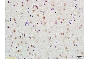 Immunohistochemistry (Paraffin-embedded Sections) (IHC (p)) image for anti-Plasminogen Activator, Urokinase Receptor (PLAUR) (AA 201-300) antibody (ABIN675443)
