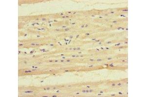 Immunohistochemistry of paraffin-embedded human heart tissue using ABIN7157751 at dilution of 1:100 (KYNU 抗体  (AA 99-214))