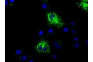 Image no. 1 for anti-Mitochondrial Translational Release Factor 1-Like (MTRF1L) antibody (ABIN1498694) (MTRF1L 抗体)