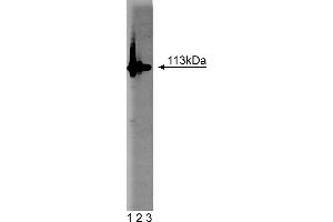 Western Blotting (WB) image for anti-Poly (ADP-Ribose) Polymerase 1 (PARP1) (AA 22-219) antibody (ABIN968333) (PARP1 抗体  (AA 22-219))