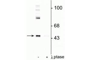 Western blot of rat cortical lysate showing specific immunolabeling of the ~50 kDa Gap-43 protein phosphorylated at Ser41 in the first lane (-). (GAP43 抗体  (pSer41))