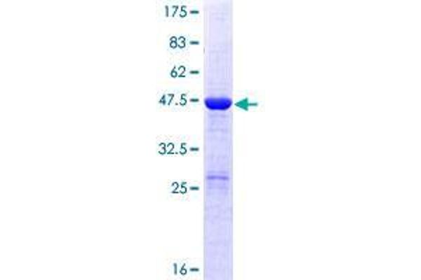 DUSP18 Protein (AA 1-188) (GST tag)