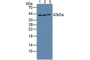 Figure. (RIPK2 抗体  (AA 432-540))