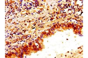 Immunohistochemistry (IHC) image for anti-Pentraxin 3 (PTX3) (AA 99-164) antibody (ABIN7162750)