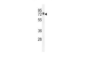 LRC40 Antibody (C-term) (ABIN654977 and ABIN2844617) western blot analysis in HepG2 cell line lysates (35 μg/lane). (LRRC40 抗体  (C-Term))