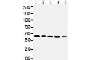 Anti-Cortisol Binding Globulin antibody, Western blotting Lane 1: HELA Cell Lysate Lane 2: A431 Cell Lysate Lane 3: U87 Cell Lysate Lane 4: 22RV1 Cell Lysate Lane 5: PANC Cell Lysate (SERPINA6 抗体  (N-Term))