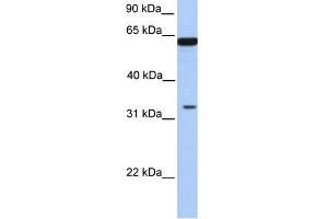 WB Suggested Anti-PERLD1 Antibody Titration:  0.