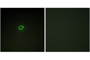 Immunofluorescence analysis of COS7 cells, using Collagen IV alpha4 Antibody. (Col4a4 抗体  (AA 541-590))