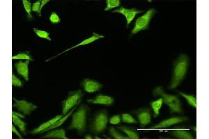 Immunofluorescence of purified MaxPab antibody to HADH on HeLa cell. (HADH 抗体  (AA 1-314))