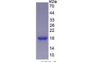 SDS-PAGE (SDS) image for Carcinoembryonic Antigen Gene Family (CEA) ELISA Kit (ABIN6730886)