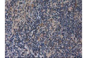 Image no. 2 for anti-Destrin (Actin Depolymerizing Factor) (DSTN) antibody (ABIN1497910) (Destrin 抗体)