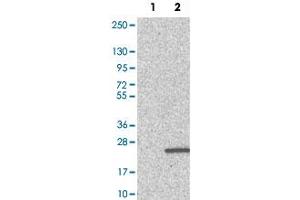 Western Blot analysis of Lane 1: negative control (vector only transfected HEK293T cell lysate) and Lane 2: over-expression lysate (co-expressed with a C-terminal myc-DDK tag in mammalian HEK293T cells) with PFDN4 polyclonal antibody . (PFDN4 抗体)