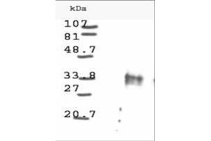 Image no. 1 for anti-Cyclin D1 (CCND1) antibody (ABIN221149) (Cyclin D1 抗体)