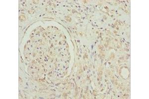Immunohistochemistry of paraffin-embedded human kidney tissue using ABIN7154750 at dilution of 1:100 (GNB1L 抗体  (AA 1-327))