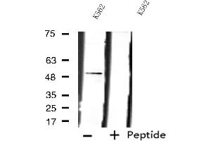 Western blot analysis of extracts from K562 cells using LPCAT2 antibody. (LPCAT2 抗体  (N-Term))