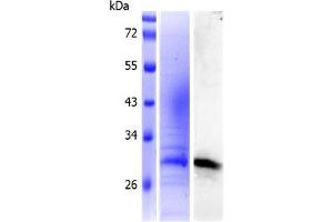 Western Blotting (WB) image for Ephrin B1 (EFNB1) (AA 28-237) protein (His tag) (ABIN3092285) (Ephrin B1 Protein (EFNB1) (AA 28-237) (His tag))