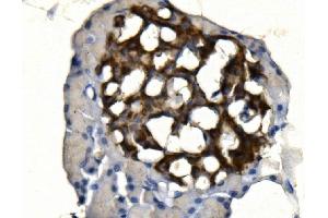 IHC analysis of SYP using anti-SYP antibody (ABIN7603120). (Synaptophysin 抗体  (N-Term))