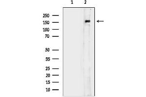 Western blot analysis of lysates from Rat kidney, using c-Met Antibody.
