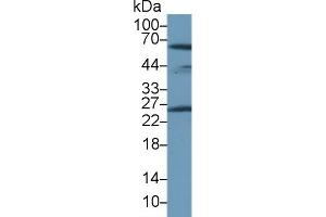 Western Blotting (WB) image for anti-Peroxiredoxin 6 (PRDX6) (AA 1-224) antibody (ABIN7436129)