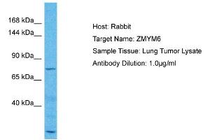 Host: Rabbit Target Name: ZMYM6 Sample Type: Lung Tumor lysates Antibody Dilution: 1. (ZMYM6 抗体  (N-Term))