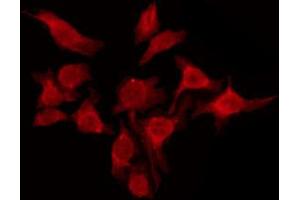ABIN6274577 staining A549 by IF/ICC. (Serotonin Receptor 6 抗体  (Internal Region))