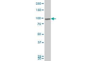 RIPK4 monoclonal antibody (M04), clone 4H5 Western Blot analysis of RIPK4 expression in A-431 . (RIPK4 抗体  (AA 675-784))