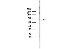 anti-5'-Nucleotidase, Cytosolic II (NT5C2) (Internal Region) antibody