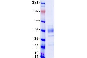 Western Blotting (WB) image for Glucosaminyl (N-Acetyl) Transferase 2, I-Branching Enzyme (I Blood Group) (GCNT2) (Transcript Variant 3) protein (Myc-DYKDDDDK Tag) (ABIN2721960)