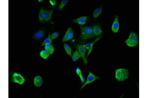 Immunofluorescence staining of MCF-7 cells with ABIN7142970 at 1:100, counter-stained with DAPI. (Acetylcholinesterase 抗体  (AA 53-162))