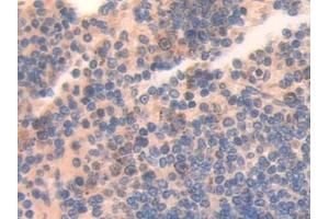 Immunohistochemistry (IHC) image for anti-Activating Transcription Factor 7 (ATF7) (AA 50-270) antibody (ABIN7441865)