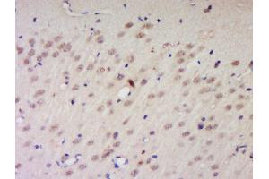 Formalin-fixed and paraffin embedded rat brain labeled with Anti-PNUTS/PPP1R10 Polyclonal Antibody, Unconjugated  at 1:200 followed by conjugation to the secondary antibody and DAB staining. (PPP1R10 抗体  (AA 151-250))