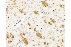 Immunohistochemistry analysis of paraffin-embedded rat brain using MBP Polyclonal Antibody at dilution of 1:500. (MBP 抗体)