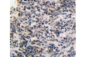 Used in DAB staining on fromalin fixed paraffin-embedded esophagus tissue (PPARG 抗体  (AA 149-273))