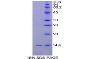 SDS-PAGE analysis of Chicken Inhibin beta B Protein. (INHBB 蛋白)