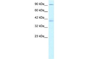 WB Suggested Anti-KIFC2 Antibody Titration:  1. (KIFC2 抗体  (N-Term))