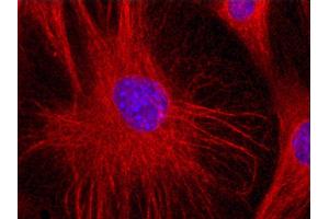 Immunofluorescence staining (mouse fibroblasts) Immunofluorescence staining of 3T3 mouse embryonal fibroblast cell line with anti-Vimentin (VI-01) Dyomics 547. (Vimentin 抗体)