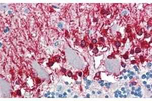 Detection of ALDH1A3 in Human Cerebellum Tissue using Polyclonal Antibody to Aldehyde Dehydrogenase 1 Family, Member A3 (ALDH1A3) (ALDH1A3 抗体  (AA 332-509))