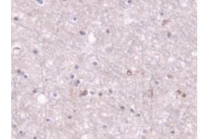 Immunohistochemistry (IHC) image for anti-Pyruvate Carboxylase (PC) (AA 36-486) antibody (ABIN7441475)