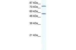 Western Blotting (WB) image for anti-Interferon Regulatory Factor 4 (IRF4) antibody (ABIN2460532) (IRF4 抗体)