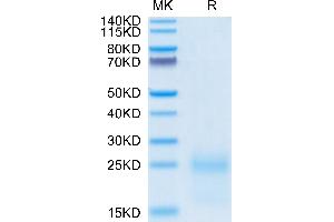 Cynomolgus TSLP on Tris-Bis PAGE under reduced condition. (Thymic Stromal Lymphopoietin Protein (TSLP) (AA 29-159) (His tag))
