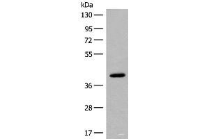 Western blot analysis of Human placenta tissue lysate using FCGRT Polyclonal Antibody at dilution of 1:400 (FcRn 抗体)